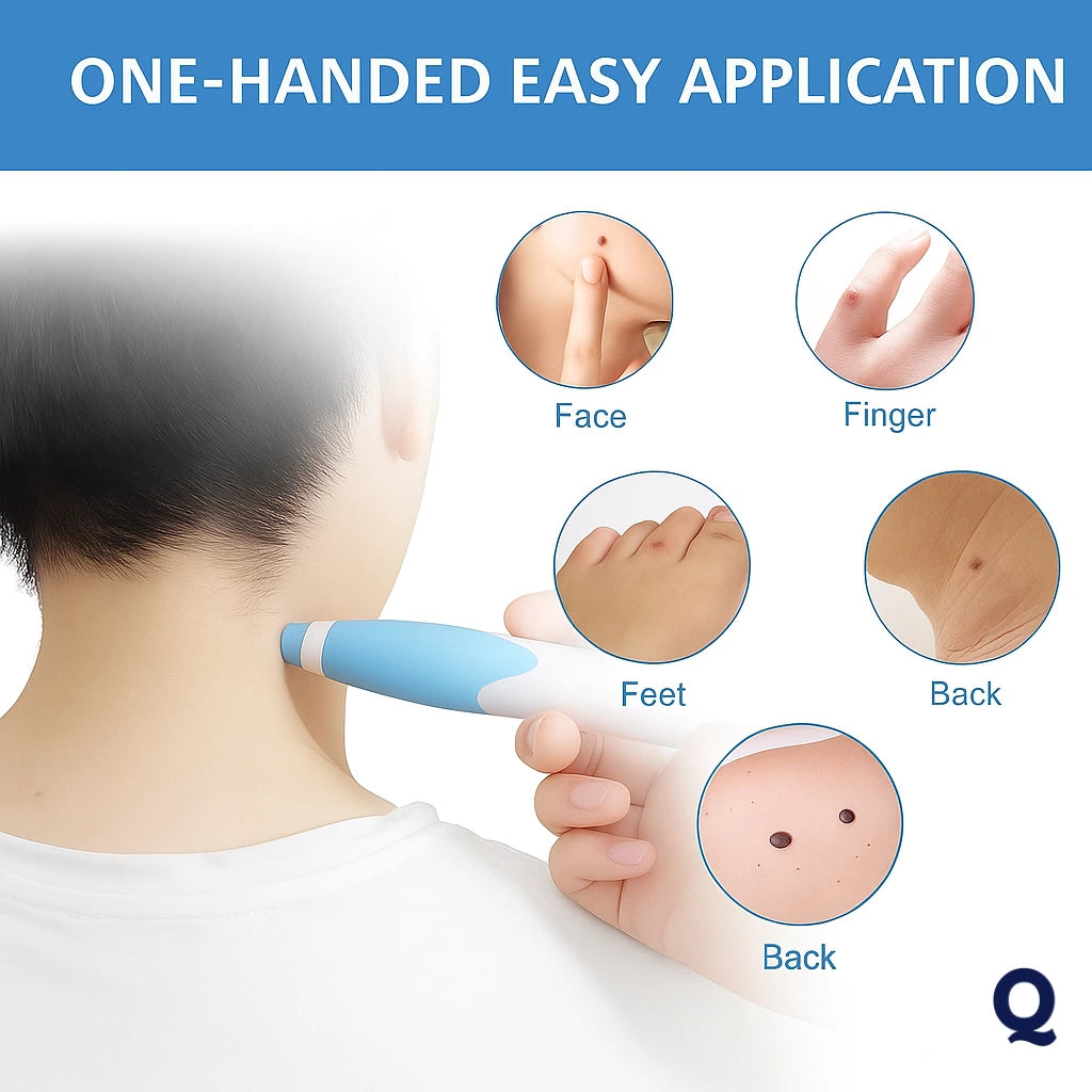 Quistara™ | No More Skin Tags