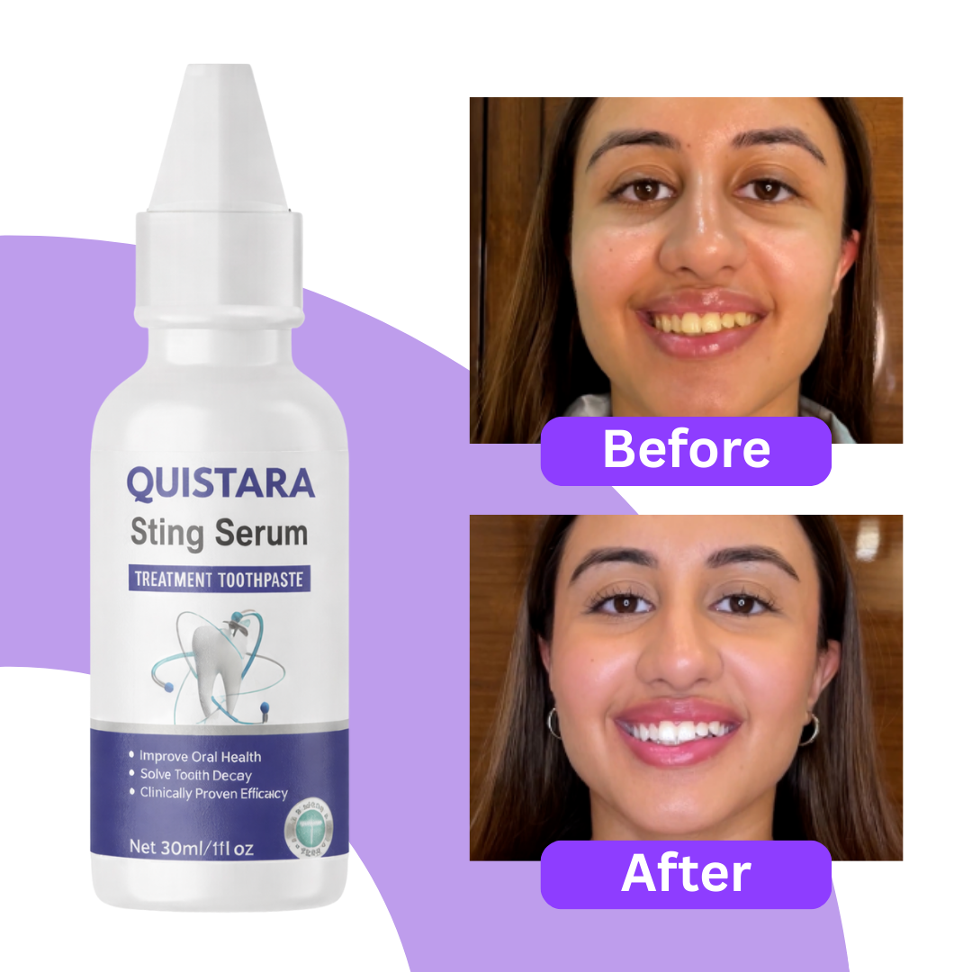 Teeth Whitening Serum (Pack of 2)