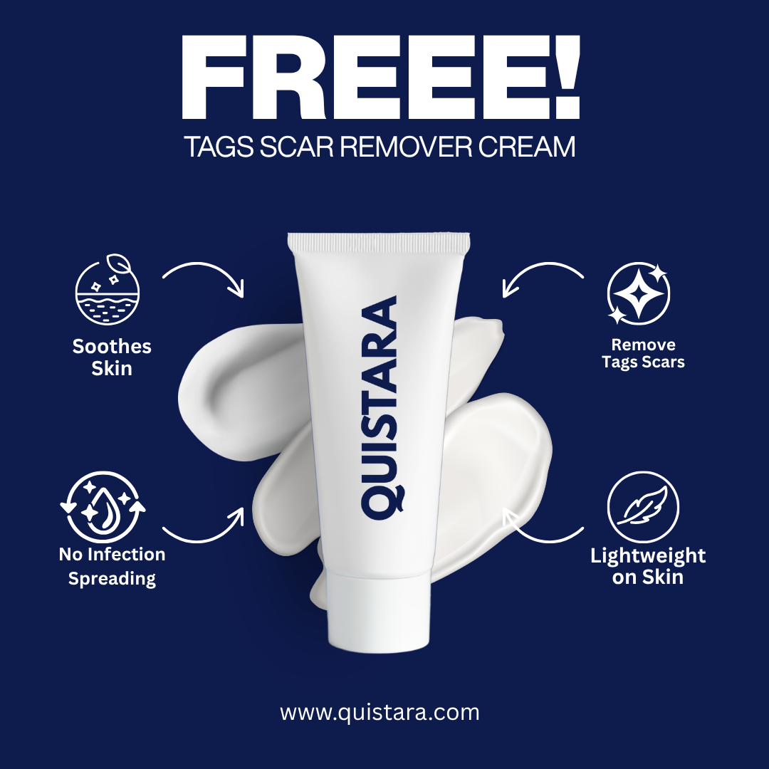 Quistara™ | No More Skin Tags