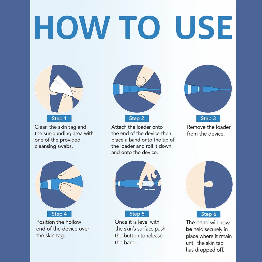 Quistara™ | No More Skin Tags