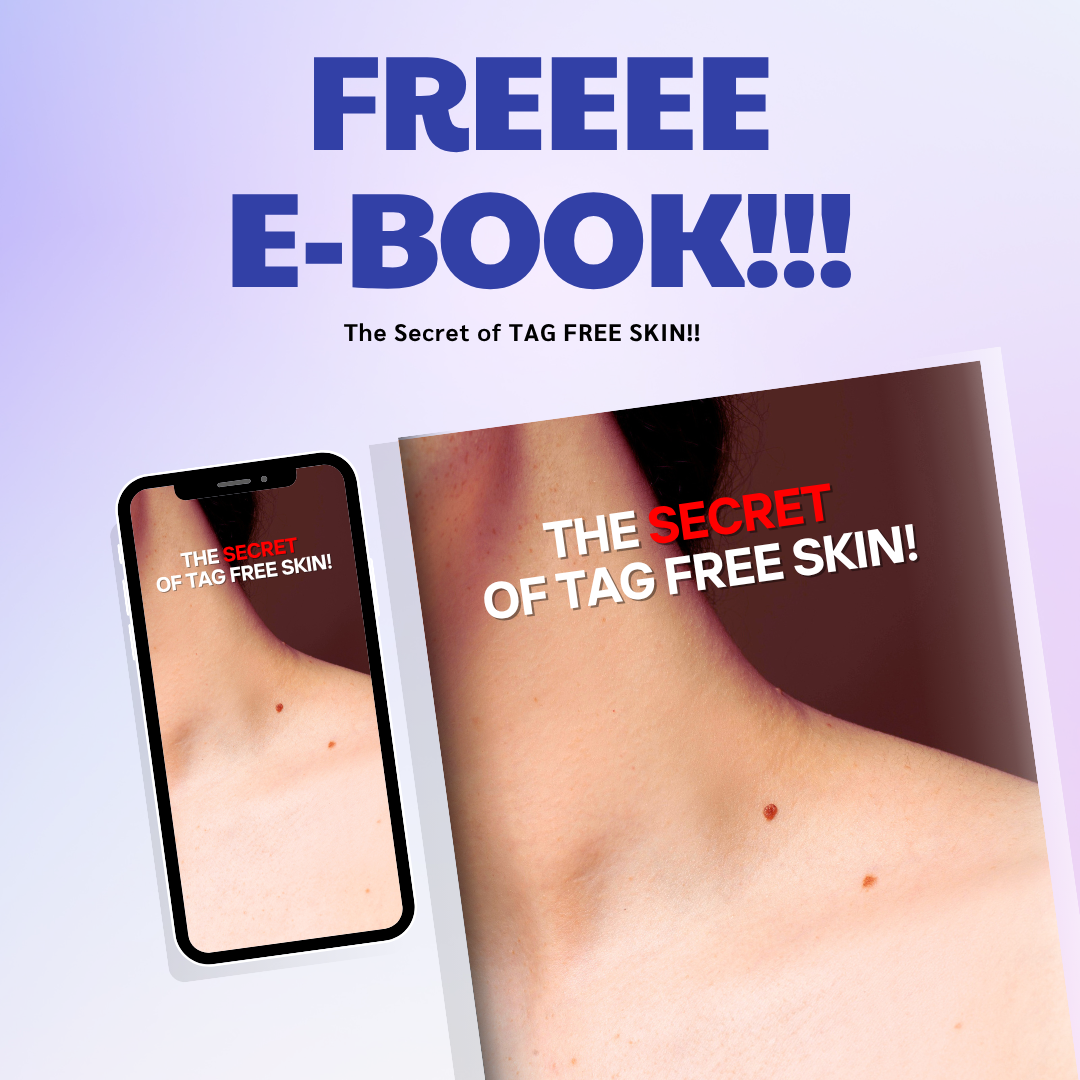 Quistara™ | No More Skin Tags